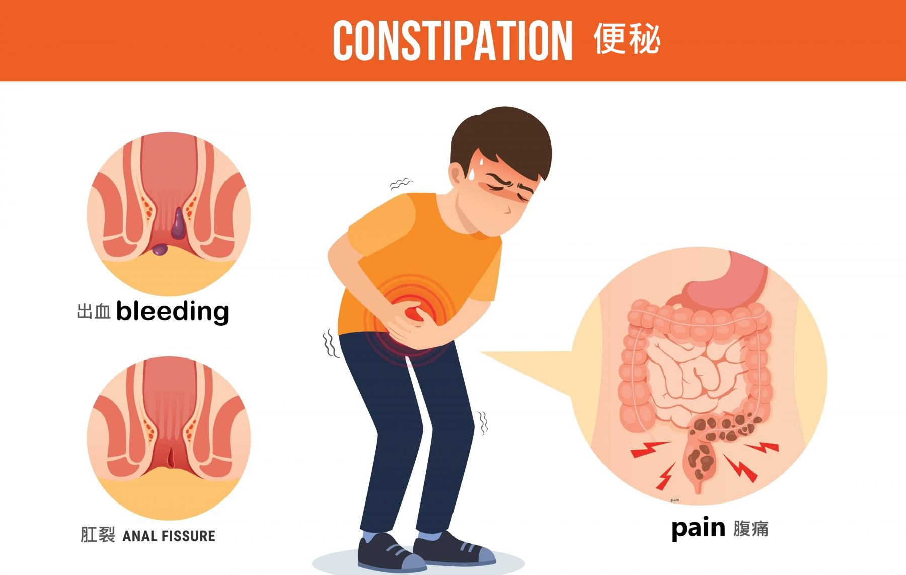 便秘併發症